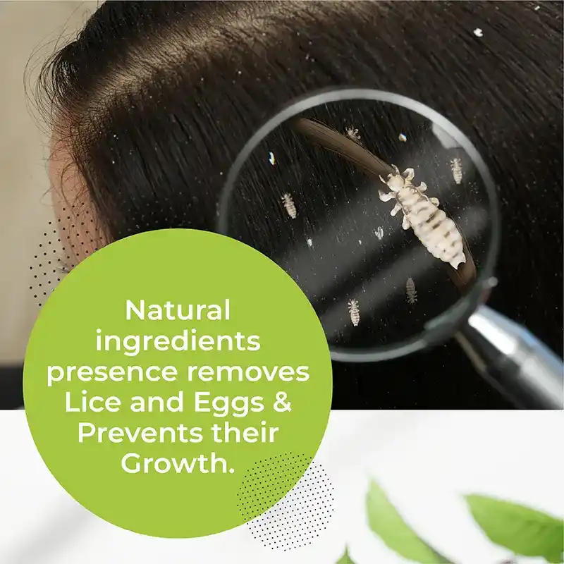 head lice removal oil